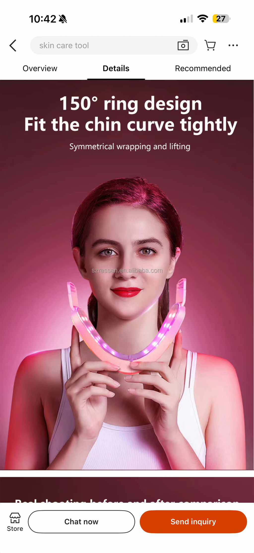 V line skin tightening